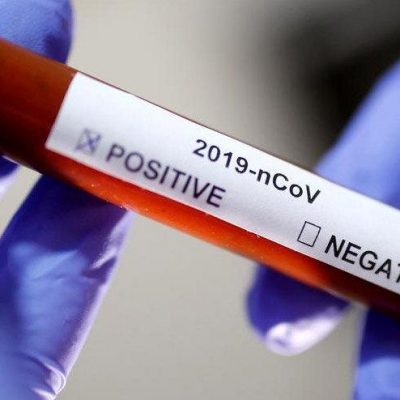 Tamamlayıcı Sağlık Sigortası’nda COVID-19’un tüm tedavi masraflarını üstleniyoruz